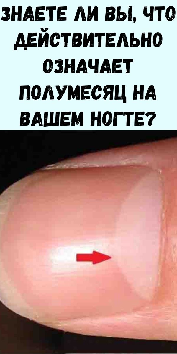 Знаете ли вы, что действительно означает полумесяц на вашем ногте? Ответ более важен, чем вы думаете