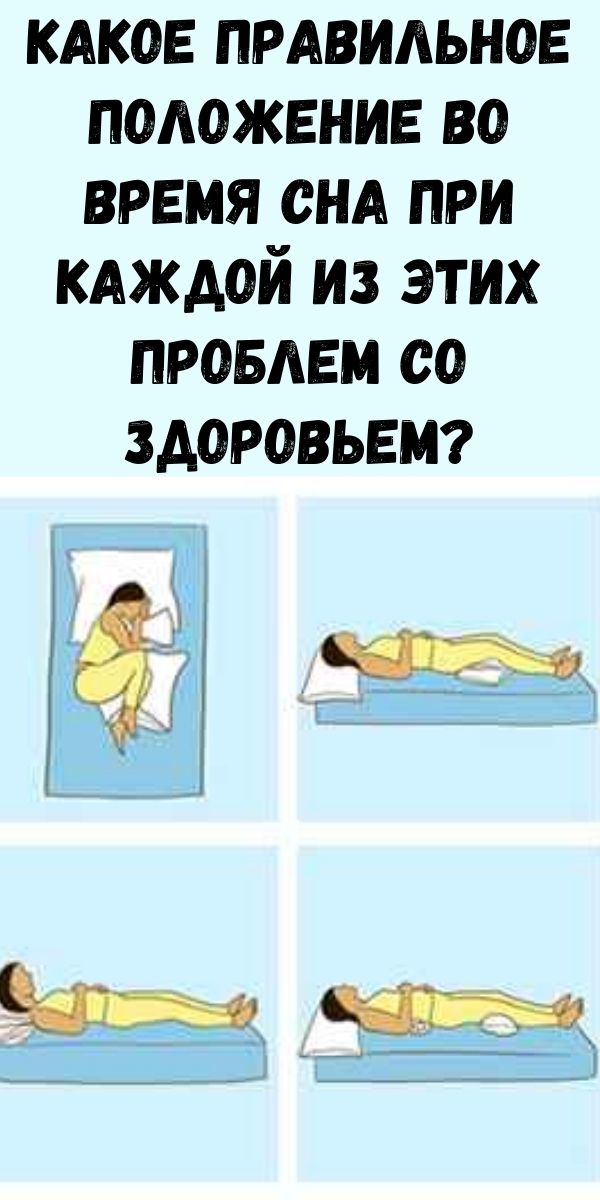 Какое правильное положение во время сна при каждой из этих проблем со здоровьем?
