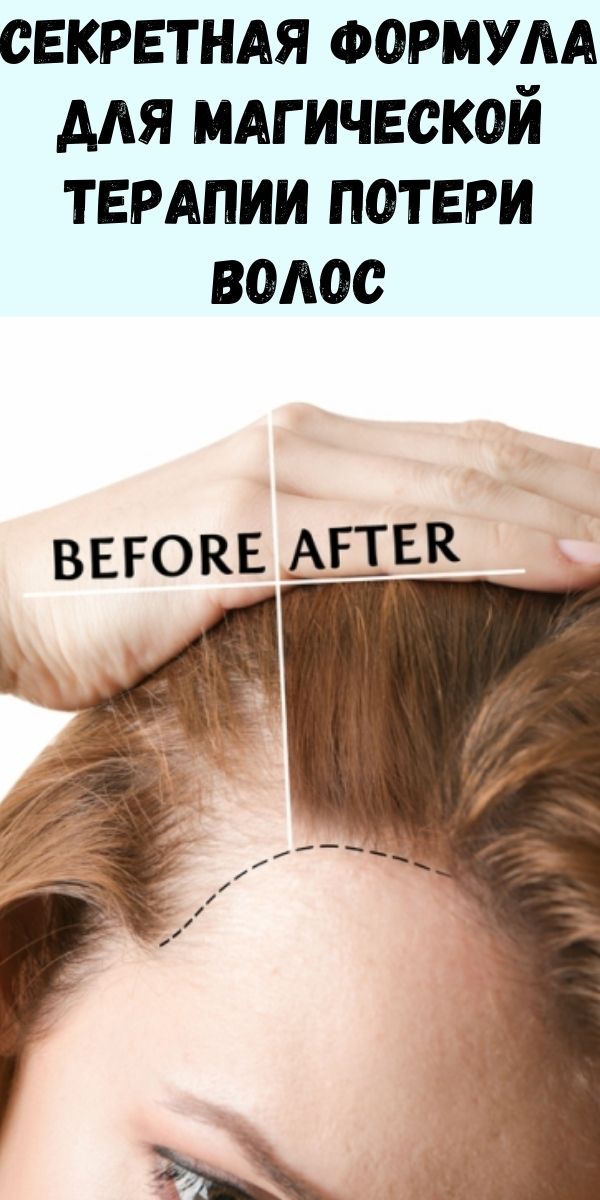 Секретная формула для магической терапии потери волос