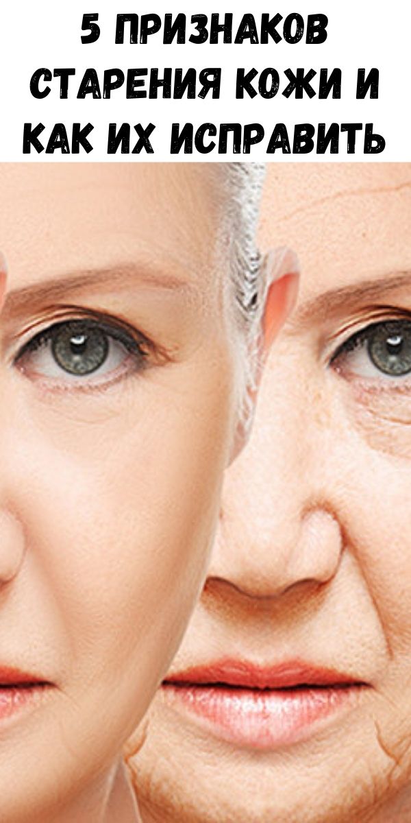 5 признаков старения кожи и как их исправить